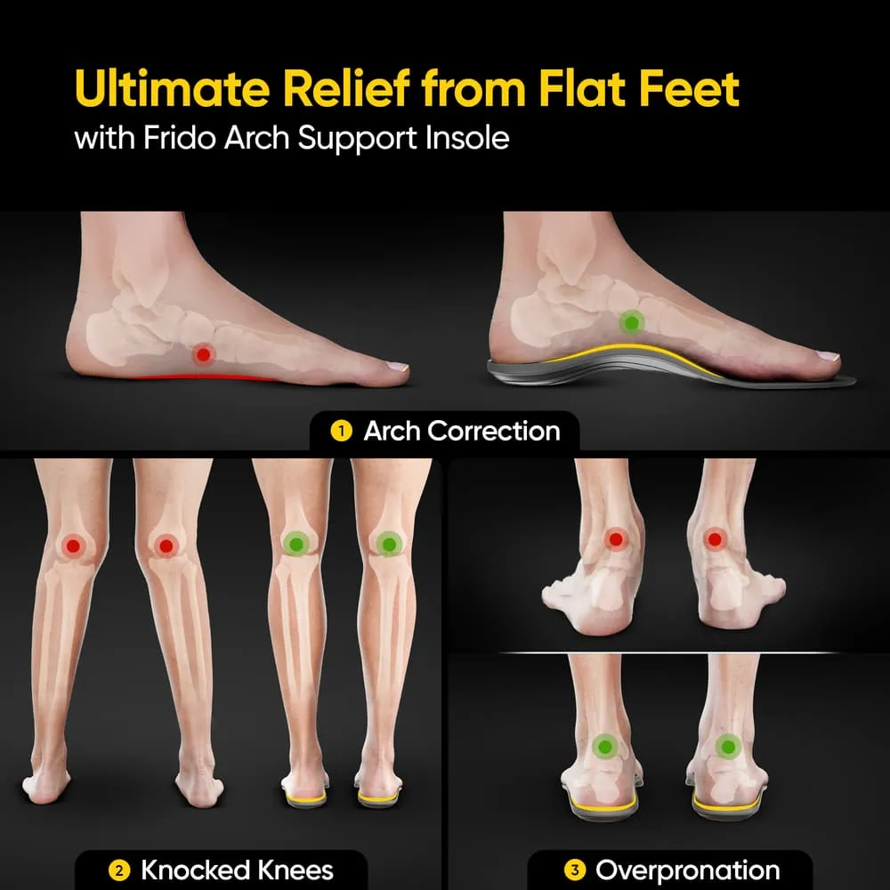 AC - Frido Arch Support Insoles Rigid   Semi Rigid Combo