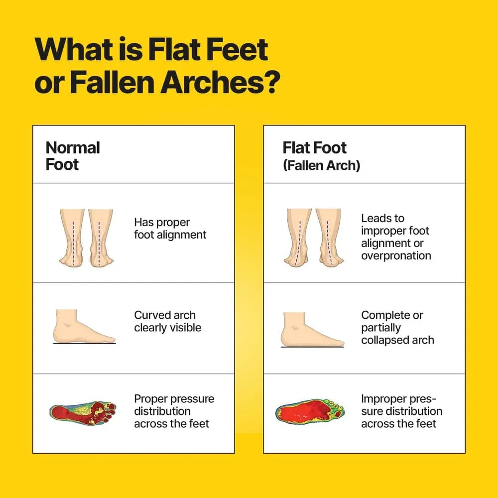 AC - Frido Arch Support Insoles Rigid   Semi Rigid Combo